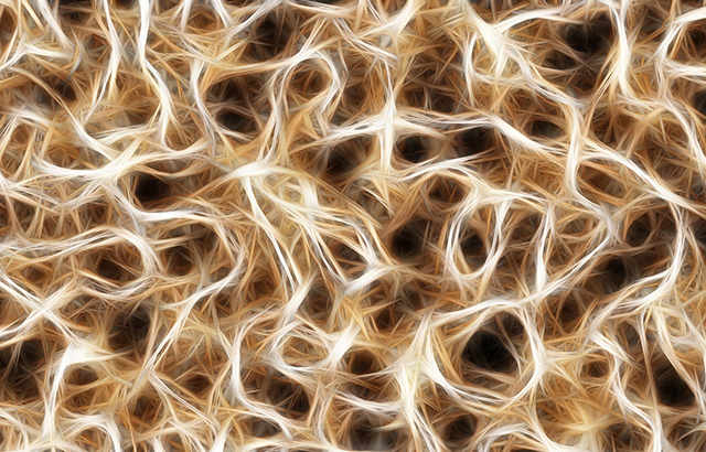 Porcine Alzheimer-associated neuronal thread protein ELISA Kit